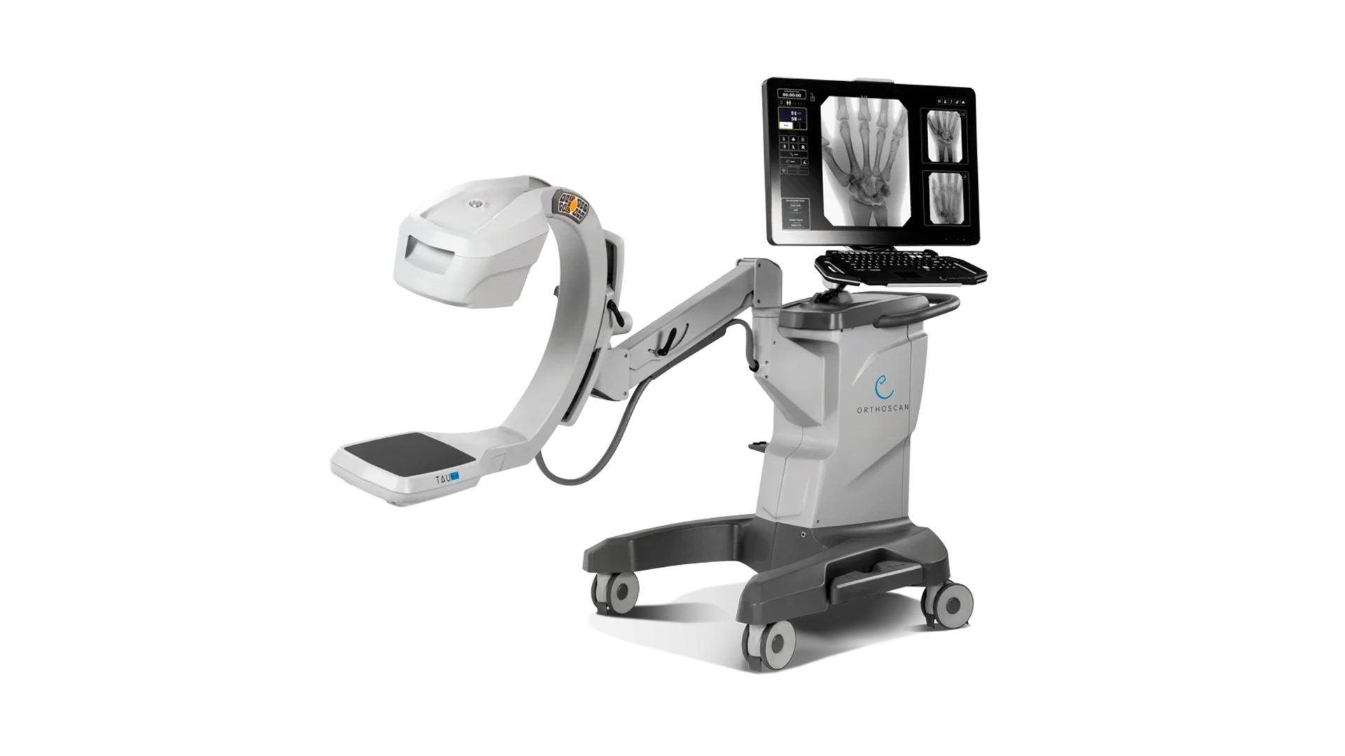 Orthoscan TAU 1512